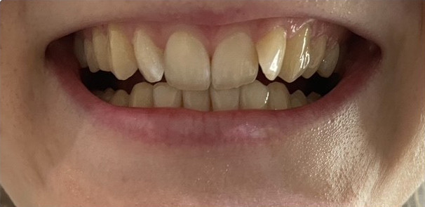 before image