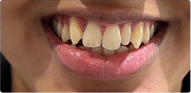 before image