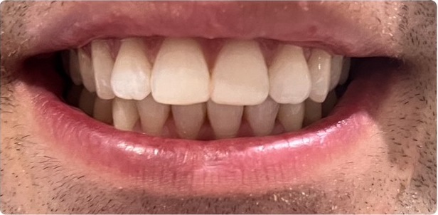 after image